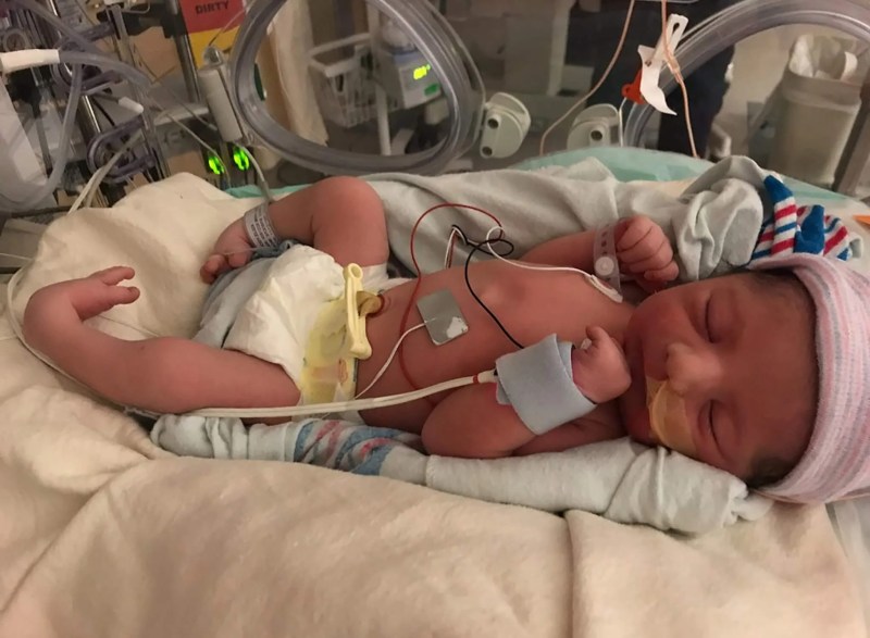 Moebius.Syndrome-ElizaMoody13-1-scaled